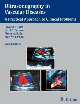 Ultrasonography in Vascular Diseases(English, Paperback, Bluth Edward I.)