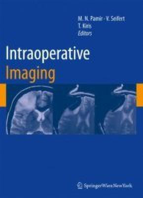 Intraoperative Imaging(English, Hardcover, unknown)