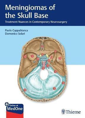 Meningiomas of the Skull Base(English, Mixed media product, unknown)