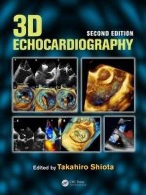 3D Echocardiography(English, Mixed media product, unknown)