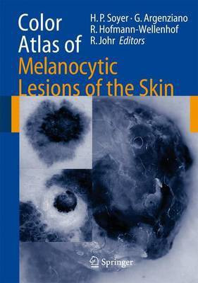 Color Atlas of Melanocytic Lesions of the Skin(English, Electronic book text, Soyer H. Peter)