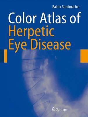 Color Atlas of Herpetic Eye Diseases(English, Electronic book text, Sundmacher Rainer)