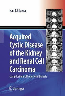 Acquired Cystic Disease of the Kidney and Renal Cell Carcinoma(English, Electronic book text, Ishikawa Isao)
