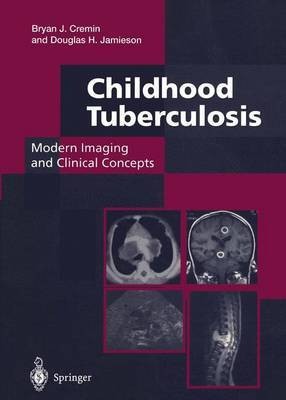 Childhood Tuberculosis: Modern Imaging and Clinical Concepts(English, Paperback, Cremin Bryan J.)