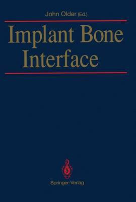 Implant Bone Interface(English, Paperback, unknown)