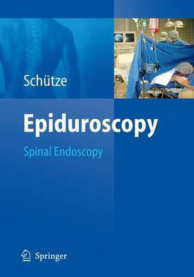 Epiduroscopy(English, Electronic book text, Schutze Gunter)