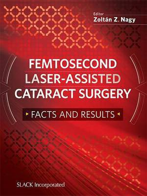 Femtosecond Laser-Assisted Cataract Surgery(English, Electronic book text, unknown)