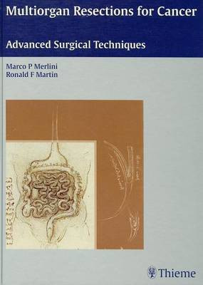 Multiorgan Resections for Cancer(English, Electronic book text, Merlini Marco)