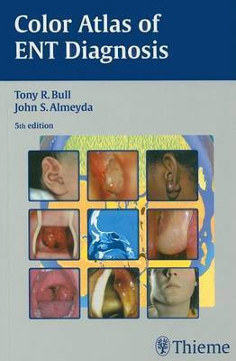 Color Atlas of Ent Diagnosis(English, Electronic book text, Bull Tony)