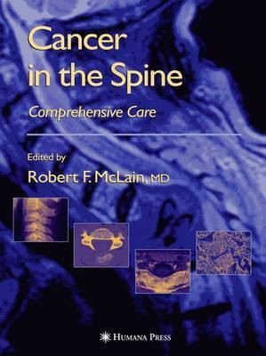 Cancer in the Spine(English, Electronic book text, McLain Robert F)