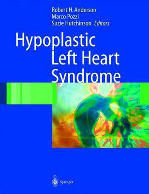 Hypoplastic Left Heart Syndrome(English, Electronic book text, Anderson Robert H)