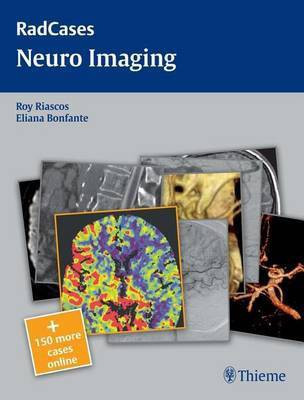 Neuro Imaging(English, Electronic book text, unknown)