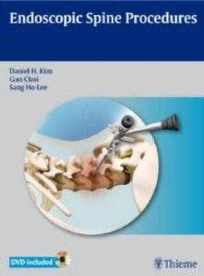 Endoscopic Spine Procedures(English, Hardcover, unknown)