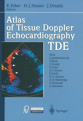 Atlas of Tissue Doppler Echocardiography - TDE(English, Hardcover, unknown)