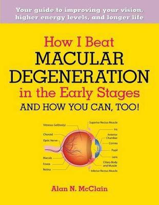How I Beat Macular Degeneration in the Early Stages and How You Can, Too!(English, Paperback, McClain Alan N)