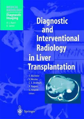 Diagnostic and Interventional Radiology in Liver Transplantation(English, Paperback, unknown)
