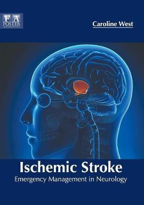 Ischemic Stroke: Emergency Management in Neurology(English, Hardcover, unknown)