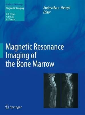 Magnetic Resonance Imaging of the Bone Marrow(English, Hardcover, unknown)