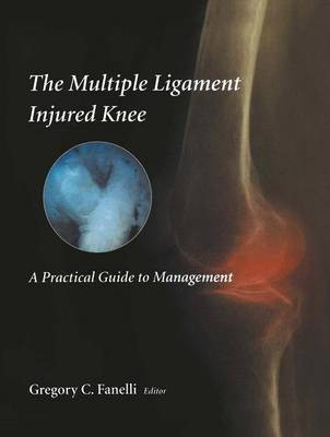 The Multiple Ligament Injured Knee(English, Paperback, unknown)