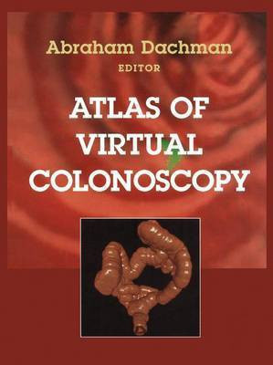 Atlas of Virtual Colonoscopy(English, Paperback, unknown)