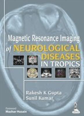 Magnetic Resonance Imaging of Neurological Diseases in Tropics(English, Hardcover, unknown)