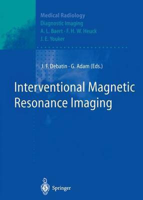 Interventional Magnetic Resonance Imaging(English, Paperback, unknown)