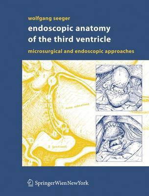 Endoscopic Anatomy of the Third Ventricle(English, Hardcover, Seeger Wolfgang)