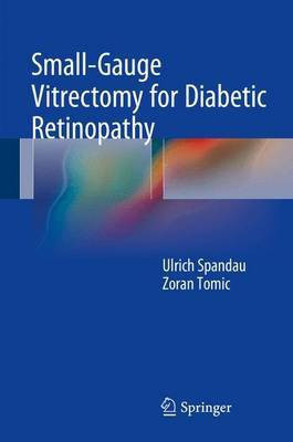 Small-Gauge Vitrectomy for Diabetic Retinopathy(English, Electronic book text, Spandau Ulrich)