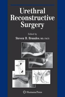 Urethral Reconstructive Surgery(English, Paperback, unknown)