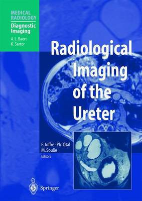 Radiological Imaging of the Ureter(English, Paperback, unknown)