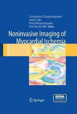 Noninvasive Imaging of Myocardial Ischemia(English, Electronic book text, unknown)