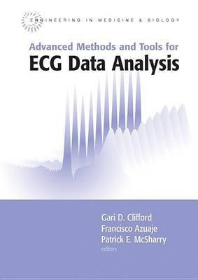 Advanced Methods and Tools for ECG Data Analysis(English, Electronic book text, Clifford Gari)