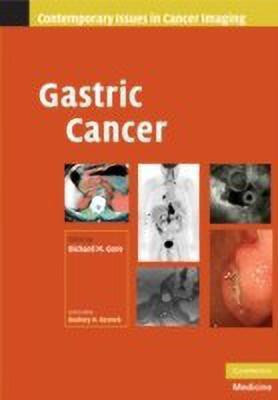 Gastric Cancer(English, Hardcover, unknown)