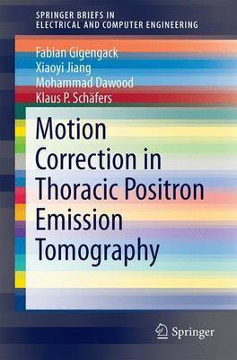 Motion Correction in Thoracic Positron Emission Tomography(English, Electronic book text, unknown)