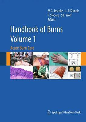 Handbook of Burns Volume 1(English, Paperback, unknown)