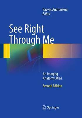 See Right Through Me(English, Paperback, unknown)