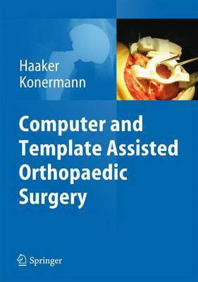 Computer and Template Assisted Orthopedic Surgery(English, Hardcover, unknown)