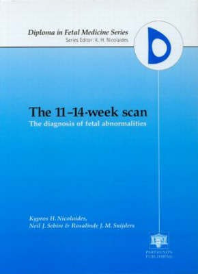 The 11-14-Week Scan: The Diagnosis of Fetal Abnormalities(English, Hardcover, unknown)