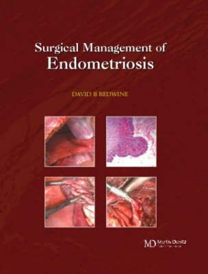 Surgical Management of Endometriosis(English, Hardcover, unknown)