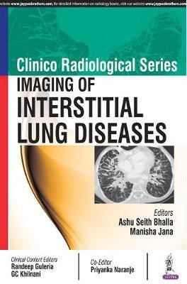 Clinico Radiological Series: Imaging of Interstitial Lung Diseases(English, Paperback, Bhalla Ashu Seith)