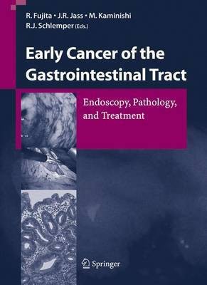 Early Cancer of the Gastrointestinal Tract(English, Hardcover, unknown)