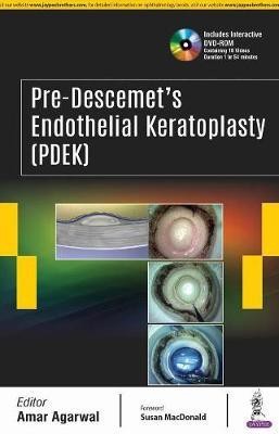 Pre-Descemet's Endothelial Keratoplasty (PDEK)(English, Hardcover, Agarwal Amar)