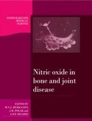 Nitric Oxide in Bone and Joint Disease(English, Paperback, unknown)