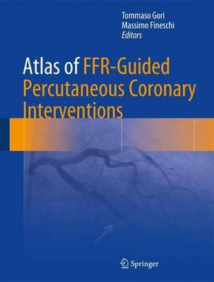 Atlas of FFR-Guided Percutaneous Coronary Interventions(English, Hardcover, unknown)