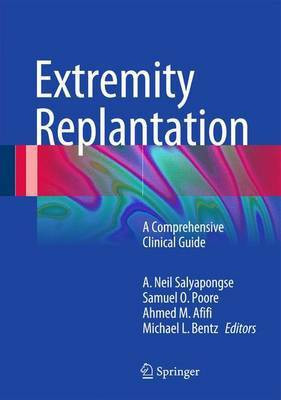 Extremity Replantation; A Comprehensive Clinical Guide(English, Electronic book text, unknown)