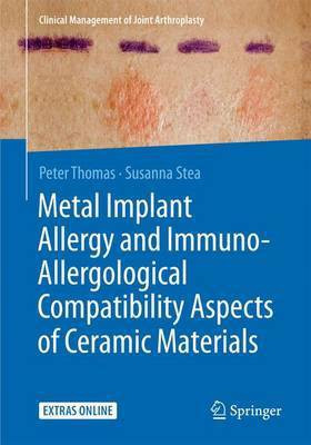Metal Implant Allergy and Immuno-Allergological Compatibility Aspects of Ceramic Materials(English, Paperback, Thomas Peter)