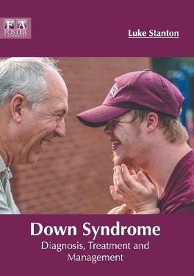 Down Syndrome: Diagnosis, Treatment and Management(English, Hardcover, unknown)