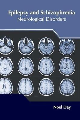 Epilepsy and Schizophrenia: Neurological Disorders(English, Hardcover, unknown)