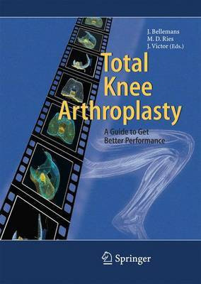 Total Knee Arthroplasty(English, Hardcover, unknown)