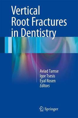 Vertical Root Fractures in Dentistry(English, Hardcover, unknown)